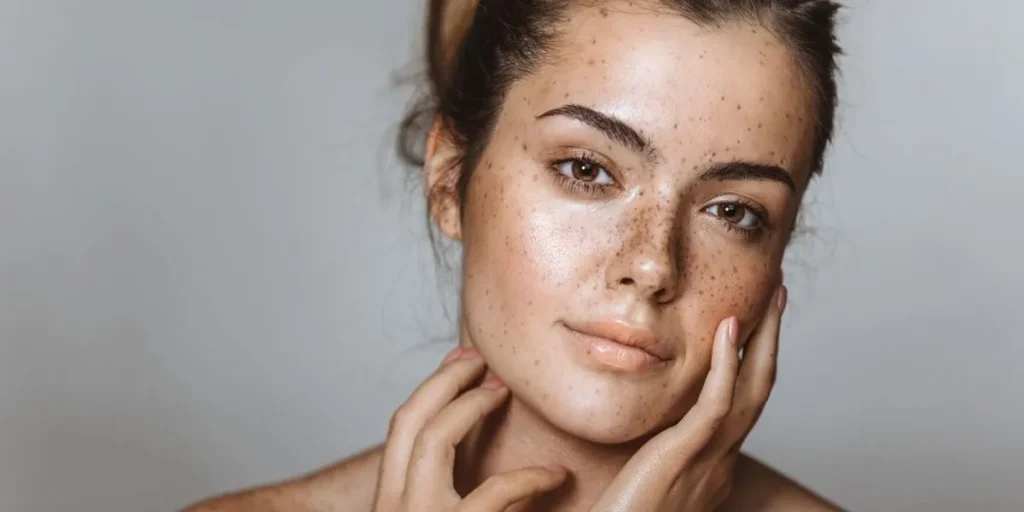 LA BELLEZA DE LAS PECAS Y EL CUIDADO QUE NECESITAN EN TU PIEL